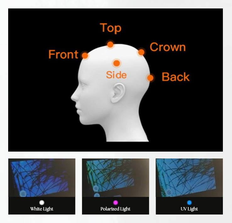 MIRROR ANALYZER WITH AI TECHNOLOGY (FOR SKIN ANALYSIS AND/OR SCALP ANALYSIS)
