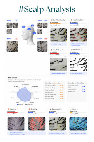 AI SCALP/SKIN ANALYSIS